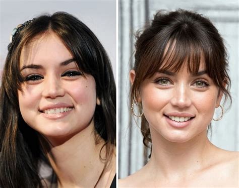 ana de armas boobs|Ana de Armas Before and After Plastic Surgery: Nose, Boob